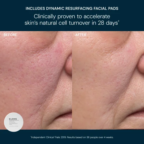 Elemis Glow Bright Resurfacing Trio zdjęcie 4